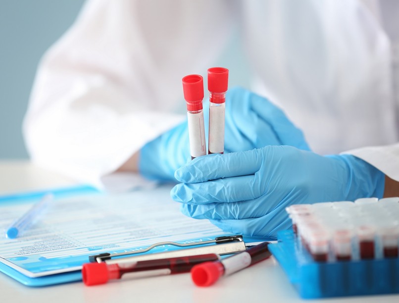 vérvétel eredmény csillag vérkép mit jelent