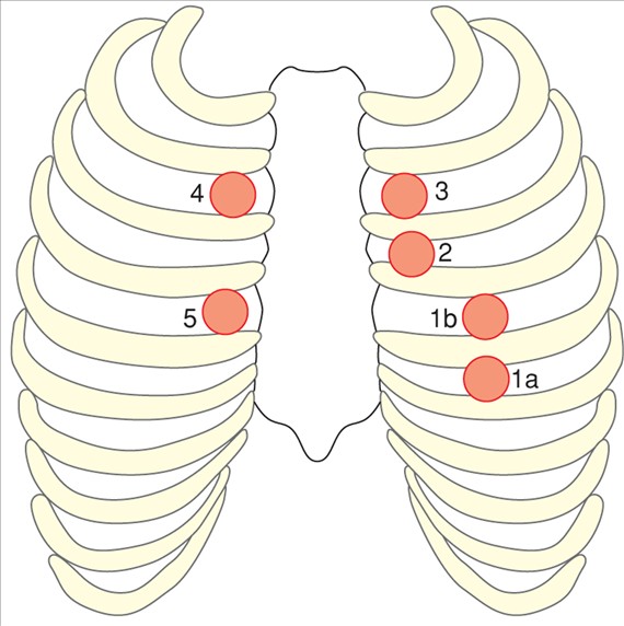 Panasz esetén a szív fizikai vizsgálata az első