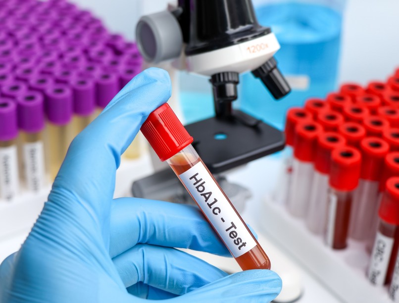 HbA1c cukorbetegség diabetes szint