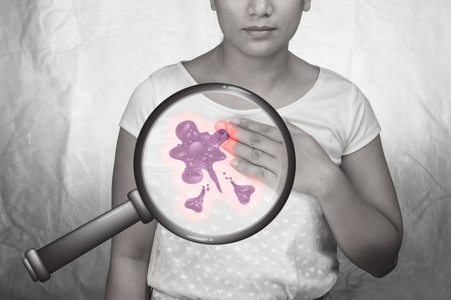 Mellrák és gombák: lehet, hogy a gombák lesznek az új szövetségeseink