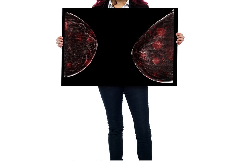 Nem ellentmondás, csak rosszul tudja: 12 tévhit az emlőrákkal kapcsolatban