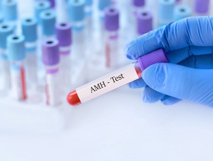 magas AMH oka miért oka petefészek
