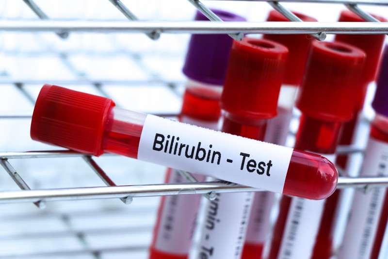 Mit jelent a bilirubin érték a laborleleten?