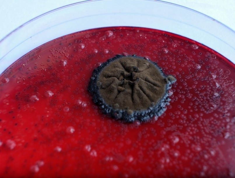 nemi úton terjedő fertőzés baktérium gonorrhoea szifilisz gonorrea