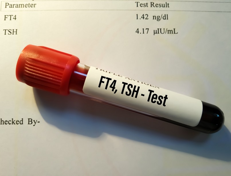 Mit jelent FT4 szabad T4 érték aborlelet