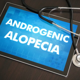 Androgén hajhullás tünetei, vizsgálata és kezelése című cikk nyitóképe