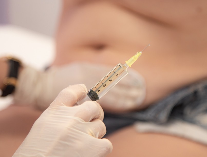 szervátültetés injekció fogyás