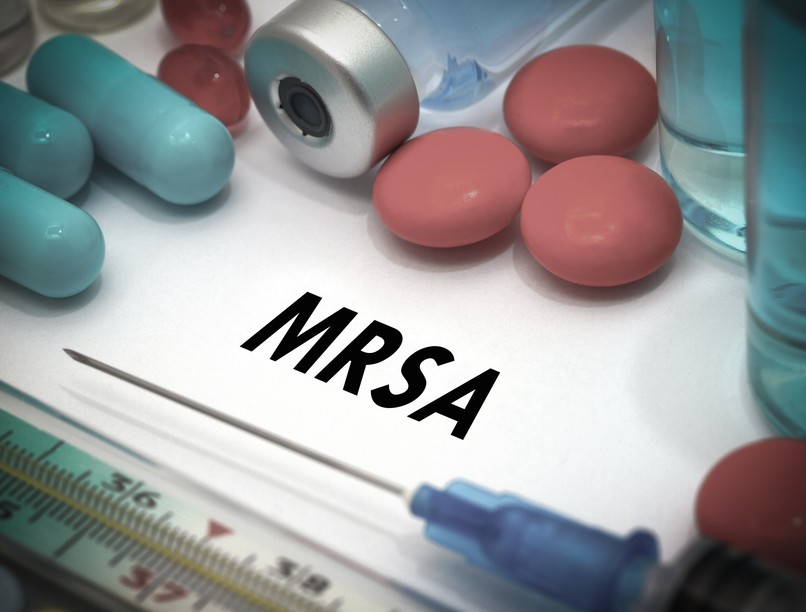 MRSA tünet vizsgálat kezelés