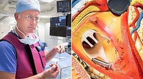 A világ legkisebb pacemakere