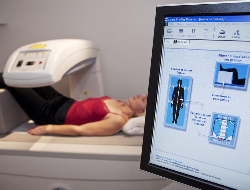 csontsűrűség mérés fenzitometria, DEXA vizsgálat leírás