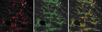 Kutatási siker: új agyi útvonal a figyelemzavarok hátterében!