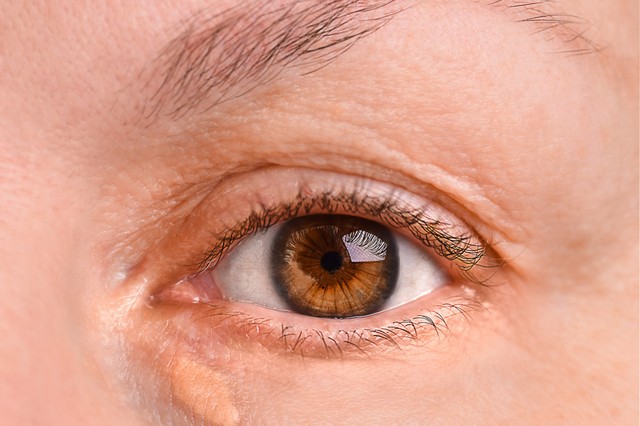 Ezzel az elváltozással jelzi a szeme, ha magas a koleszterinszintje