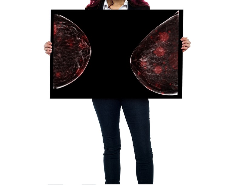 mellrák, emlőrák, megelőzés, tévhit, ellentmondás, mammográfia, daganat