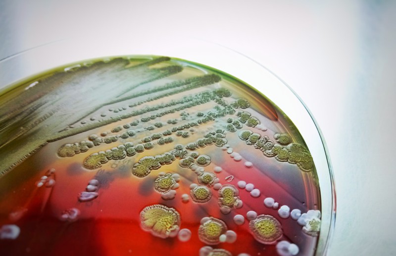 Mit lett volna, ha? Élhetne még az anyukám? Az orvos válaszol