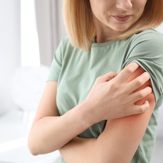 Mire utal a viszkető bőrkiütés? című cikk nyitóképe