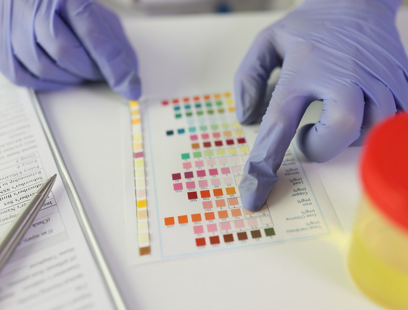 fokozott izzadás hőség veszélyes vese