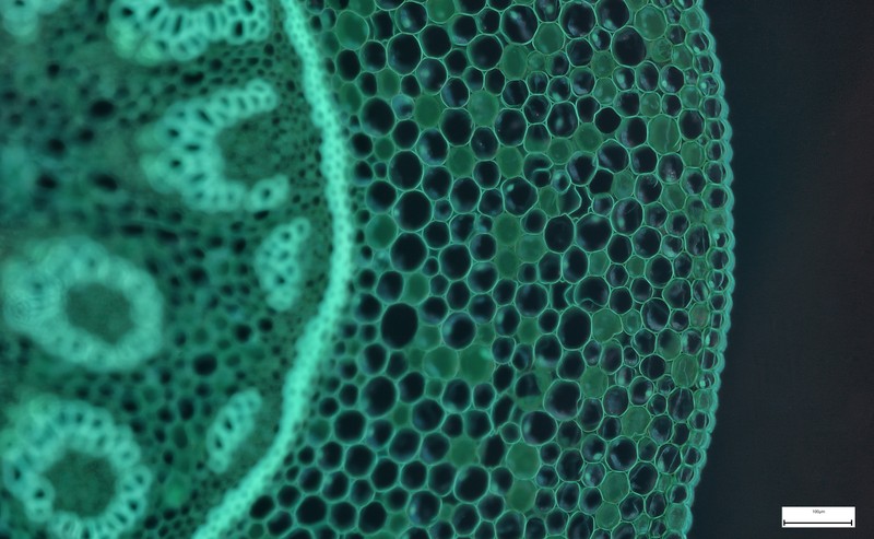 Mi a sejtszintű terápia (sejtterápia)?