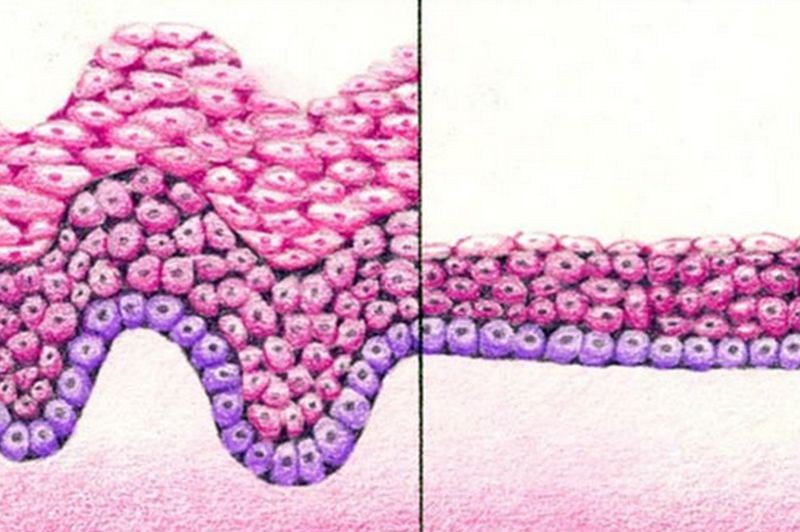 Kényelmetlen titok: hüvelyszárazság