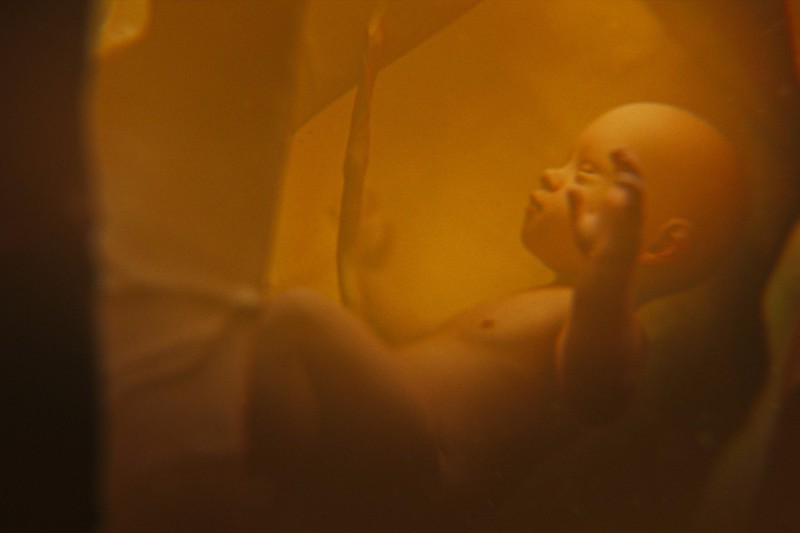 Drámaian megnőtt hazánkban a veleszületett szifilisz előfordulása