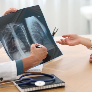Milyen gyakran lehet röntgenezni? Ez a modern orvostudomány válasza egy régi félelemre című cikk nyitóképe