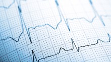 Gyorsabban olvassa az EKG-t, mint az orvosok? Egy új AI-eszköz másodpercek alatt kiszúrja a két legveszélyesebb szívbetegséget az EKG-ból című cikk nyitóképe