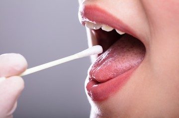 Ezeket a betegségeket nyálból is ki lehet mutatni 