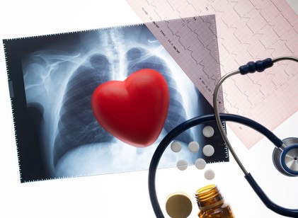 Béta-blokkolók: egy idő után abba lehet hagyni? A kutatók szerint ennyi kezelési idő is elegendő lehet szívroham után című cikk nyitóképe