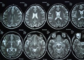 Felesleges sugárterhelés?