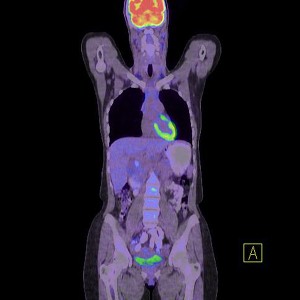 A PET/CT lényege