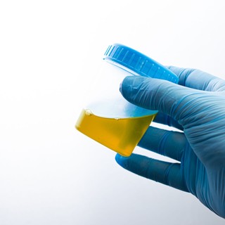 Egy vizeletminta, ami többet mond a koráról, mint a személyije című cikk nyitóképe