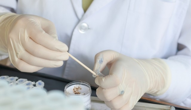 Majomhimlő: vizeletben és nyálban is találtak mintát