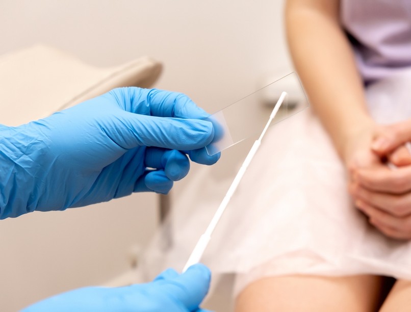 hüvelygomba, candida, gombás fertőzés, vakcinainfó az orvos válaszol