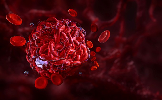 Mi az antikoaguláns kezelés (véralvadásgátló terápia)? című cikk nyitóképe