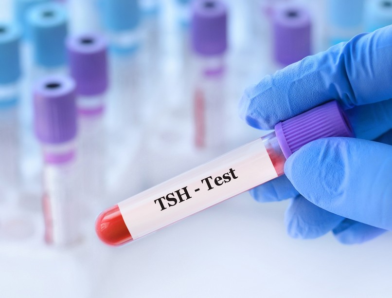 Mit jelent TSH érték laborlelet