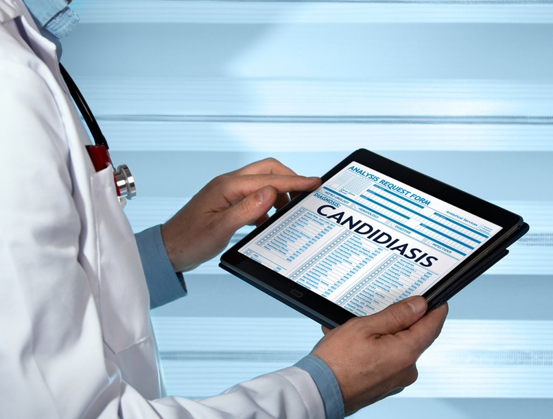 Candida-fertőzés, candidiasis, oka, tünete és kezelése, gombás fertőzés, élesztőgomba