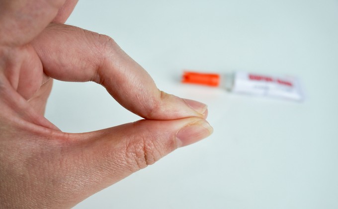 Így távolíthatja el a pillanatragasztót a bőréről című cikk nyitóképe