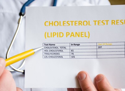 Triglicerid szint: mi ez, miért fontos, és hogyan lehet egészséges szinten tartani? című cikk nyitóképe