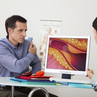 Sokan nem veszik komolyan: ezek a jelek árulkodhatnak arról, hogy az artériái beszűkültek című cikk nyitóképe