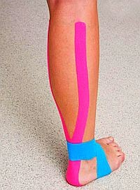 Gyógytornák: Mire jó a Kinesio Tape?