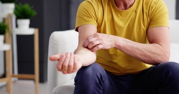  Rozacea, pikkelysömör, atópiás dermatitisz: ezt tanácsolja a bőrgyógyász télre 