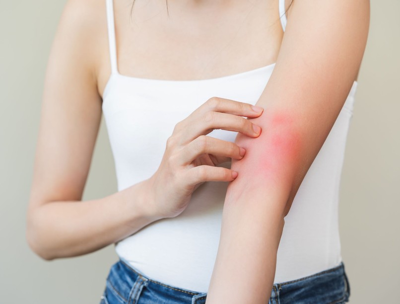 ekcéma atópiás dermatitisz életminőség alvás