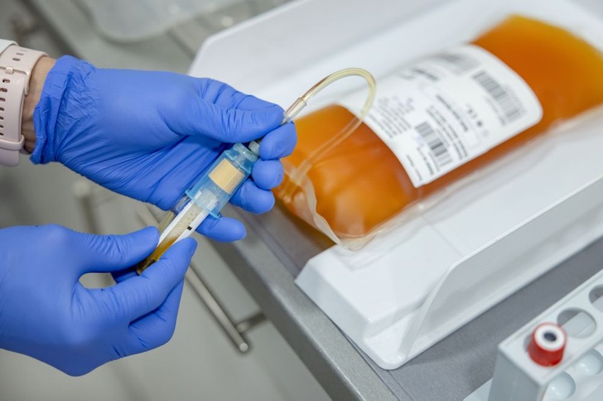 Mintavétel a plazmából