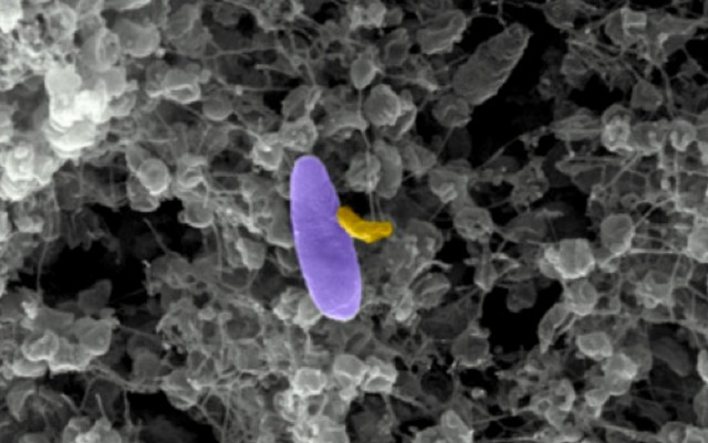 Tüzet tűzzel: vámpír-baktériumot küldenének az embernek ártó kórokozókra