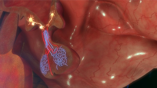 Erős, krónikus fejfájás: ilyen korai tünetekkel kezdődik az agy egyik daganatos betegsége