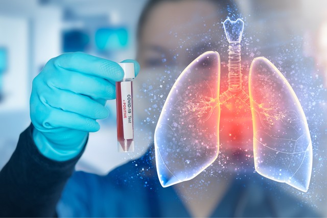 Mit tesz a tüdővel a covid-19? Vakcinainfó - Az orvos válaszol