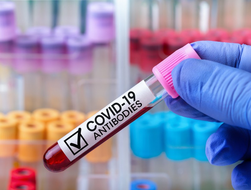 ellenanyagszint-mérés, antitest, antigén, vakcina, koronavírus