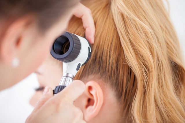 Gombás fertőzésnek hitte az orvos a fiatal nő rákos anyajegyét