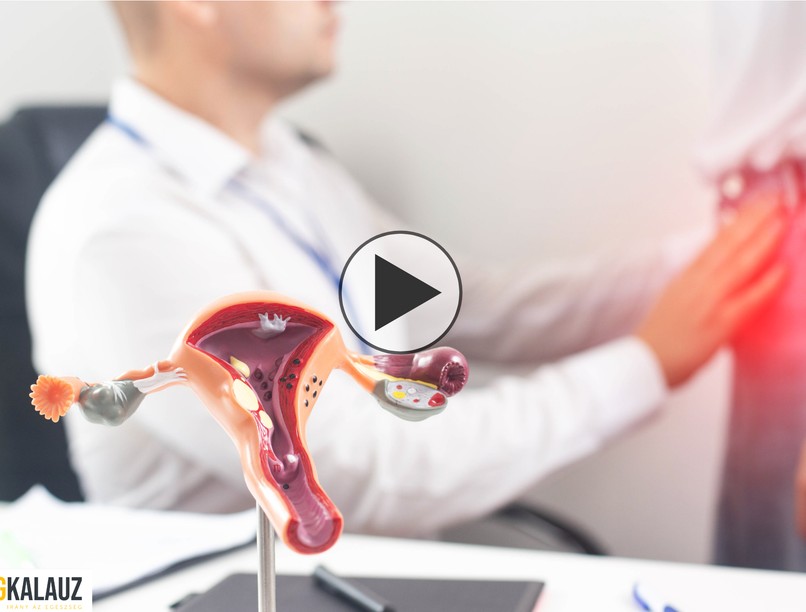 nőgyógyászat, vérzészavarok, menstruáció, szülész-nőgyógyász, Dr. László Dánel, orvos válaszol, videorendelő
