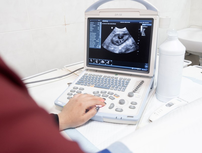 Molaterhesség Mola hydatidosa tünet vizsgálat kezelés