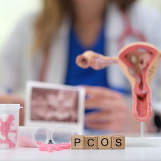 Hogyan gyógyítható a PCOS? Ez az, amit jó tudni a diagnózis után című cikk nyitóképe